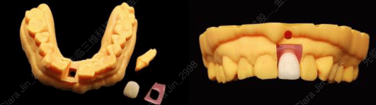 ��� ����� GM12 (Gingiva Mask Resin)